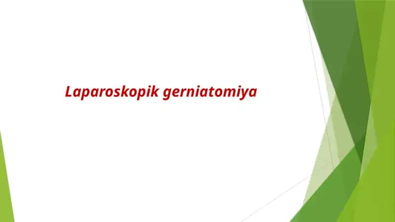 Laparoskopik gerniatomiya
