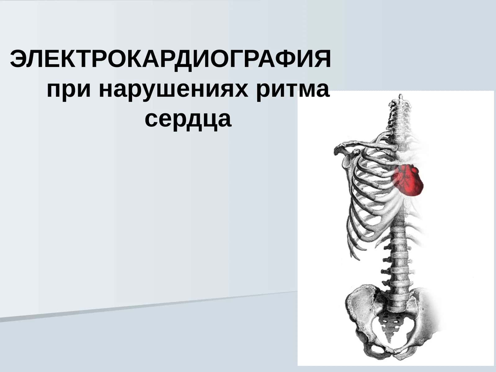 ЭЛЕКТРОКАРДИОГРАФИЯ