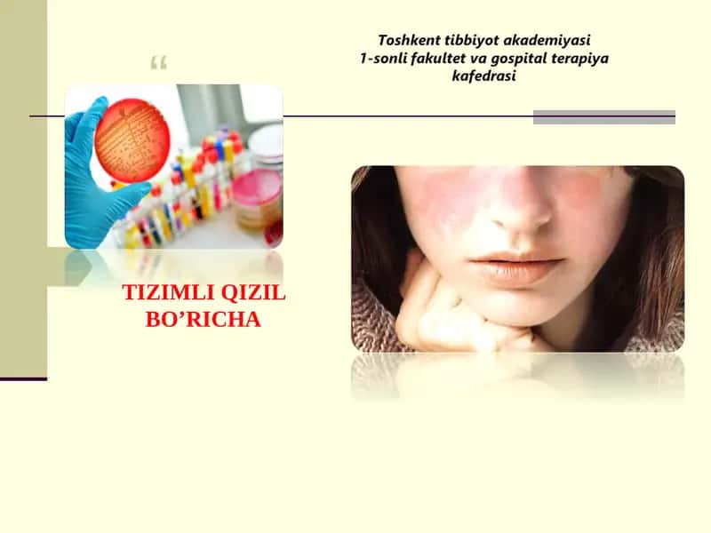 Tizimli Qizil Bo’richa