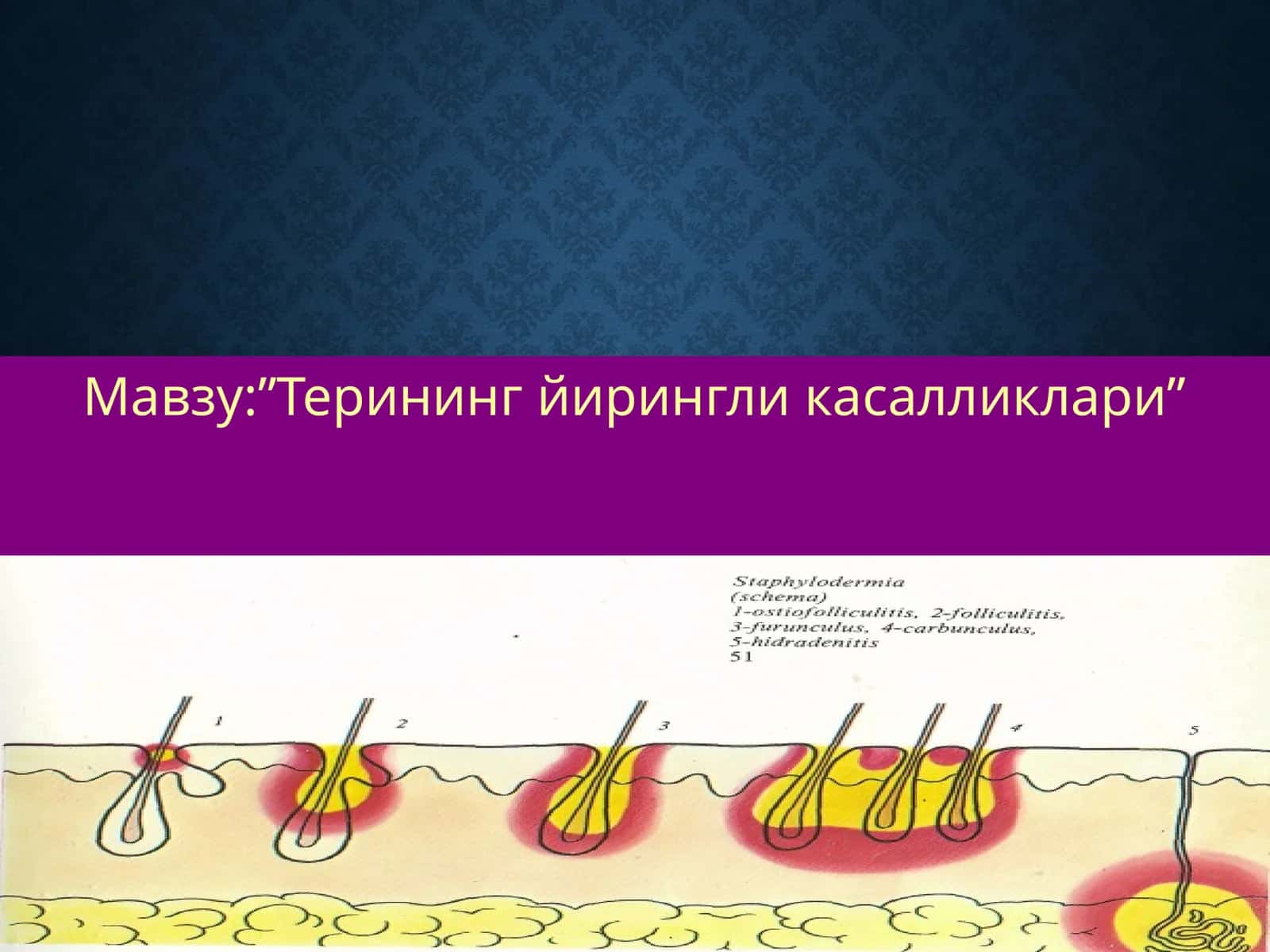 Терининг йирингли касалликлари