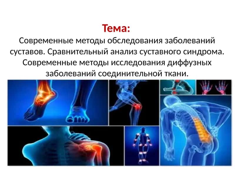 Современные методы обследования заболеваний суставов. Сравнительный анализ суставного синдрома. Современные методы исследования диффузных заболеваний соединительной ткани.