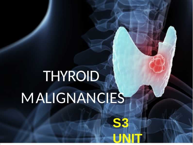 THYROID  MALIGNANCIES