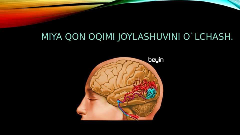 MIYA QON OQIMI JOYLASHUVINI O`LCHASH