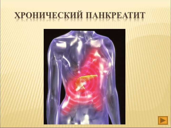 Хронический панкреатит