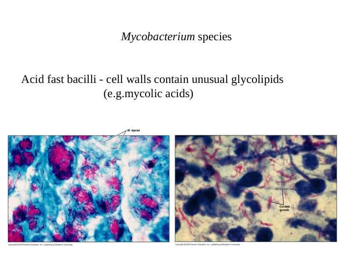 EID-tuberculosis