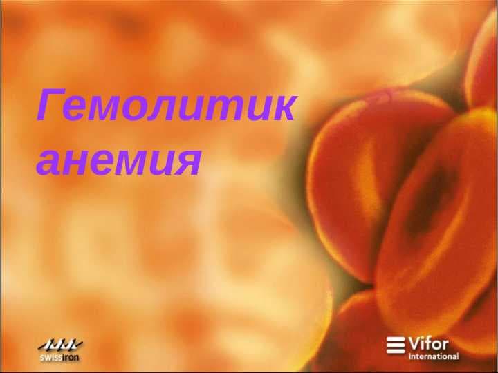 Гемолитик  анемия
