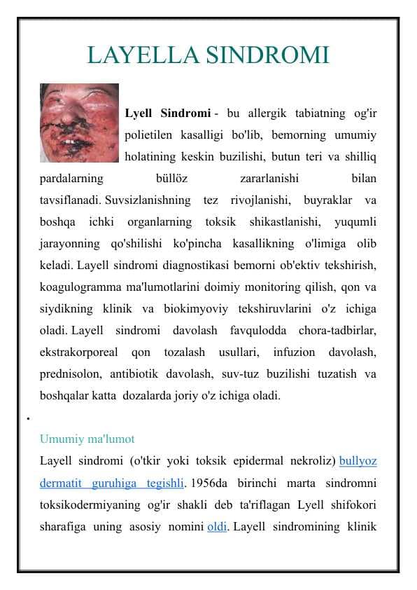 LAYELLA SINDROMI