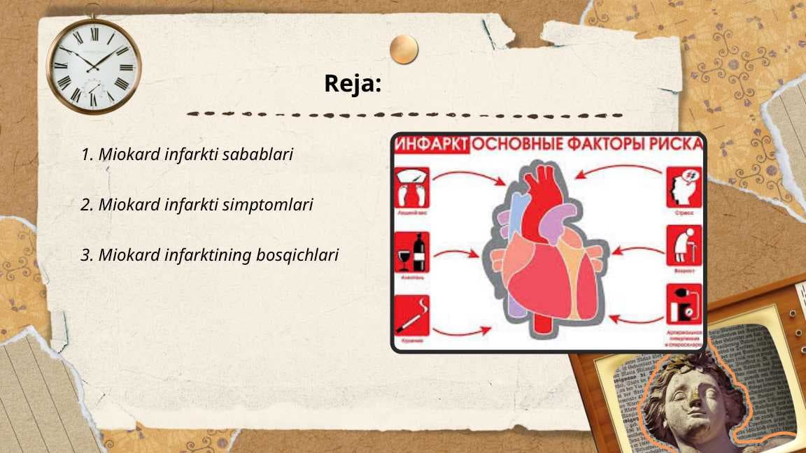 Miokard infarkti
