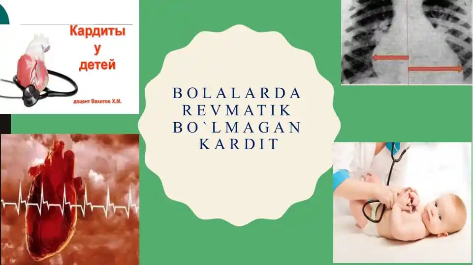 BOLALARDA REVMATIK BO`LMAGAN KARDIT