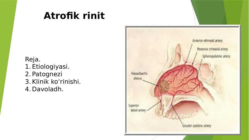 Atrofik rinit