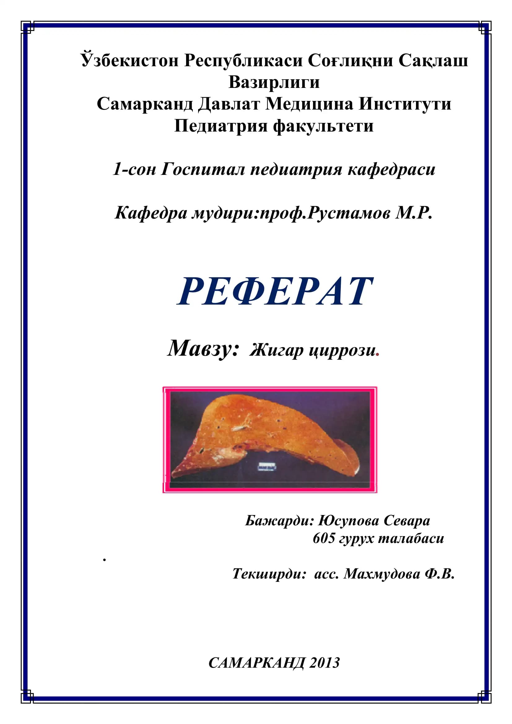 Жигар циррози