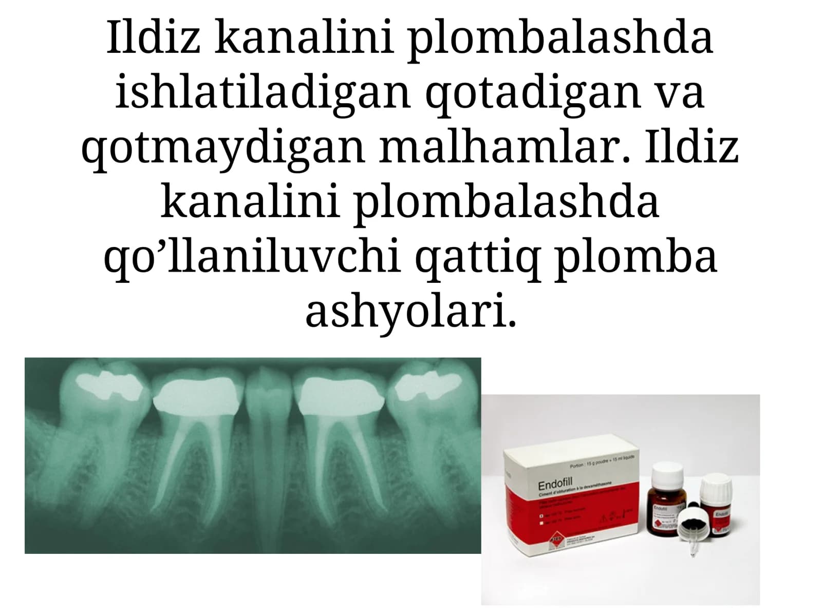 Ildiz kanalini plombalash