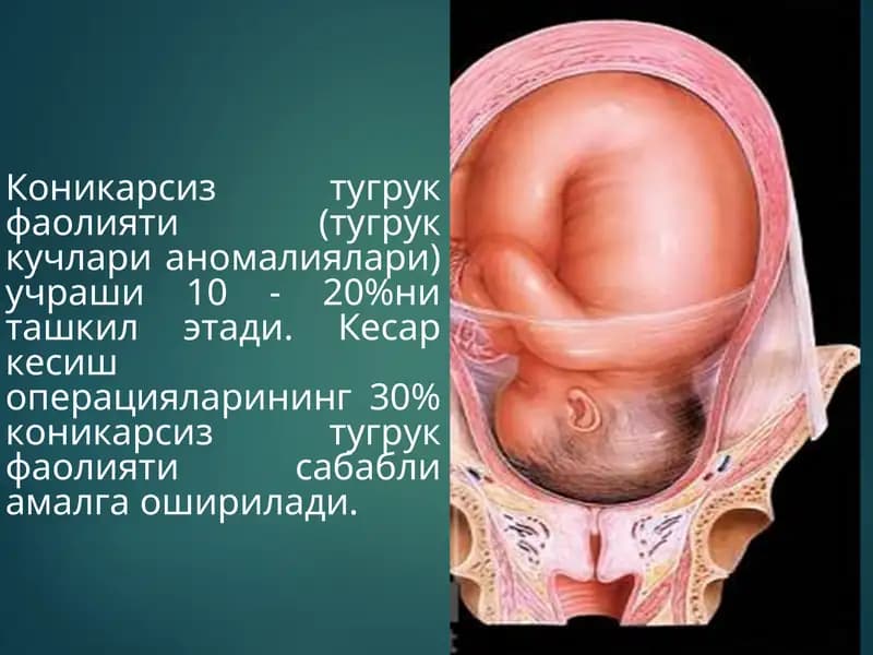 Коникарсиз туғруқ фаолияти