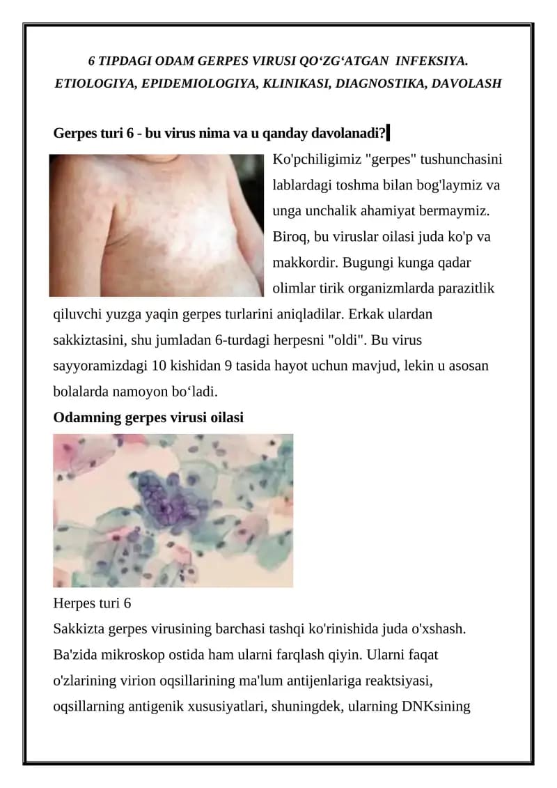 Gerpes turi 6