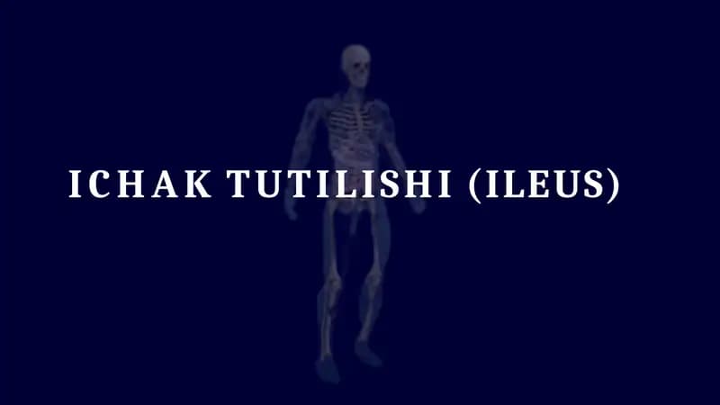 Ichak tutilishi taqdimot