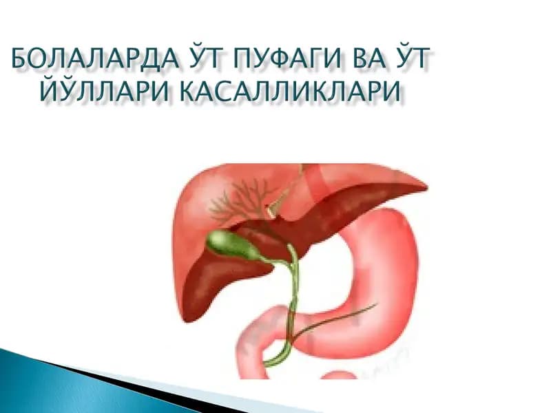Холецистит
