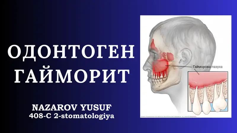 ODONTOGEN GAYMORIT