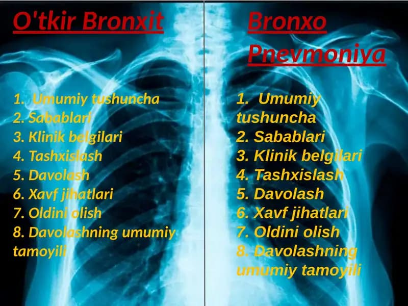 O'tkir Bronxit.  Bronxopnevmoniya