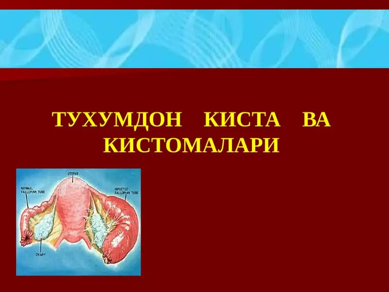 TUXUMDON KISTA VA KISTOMALARI