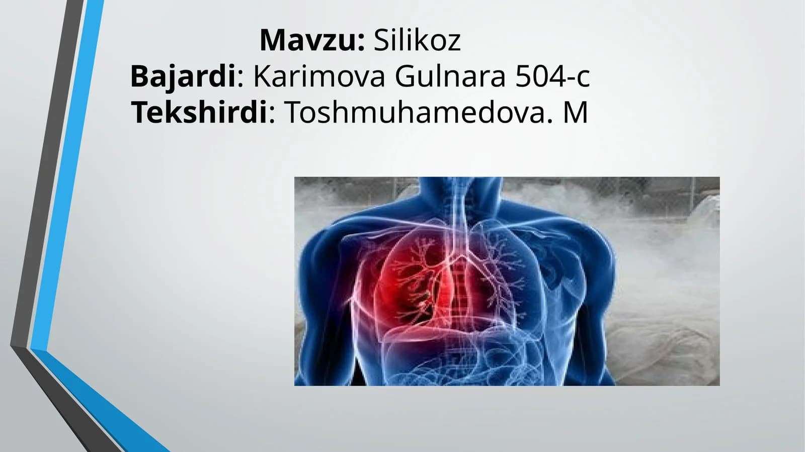Silikoz