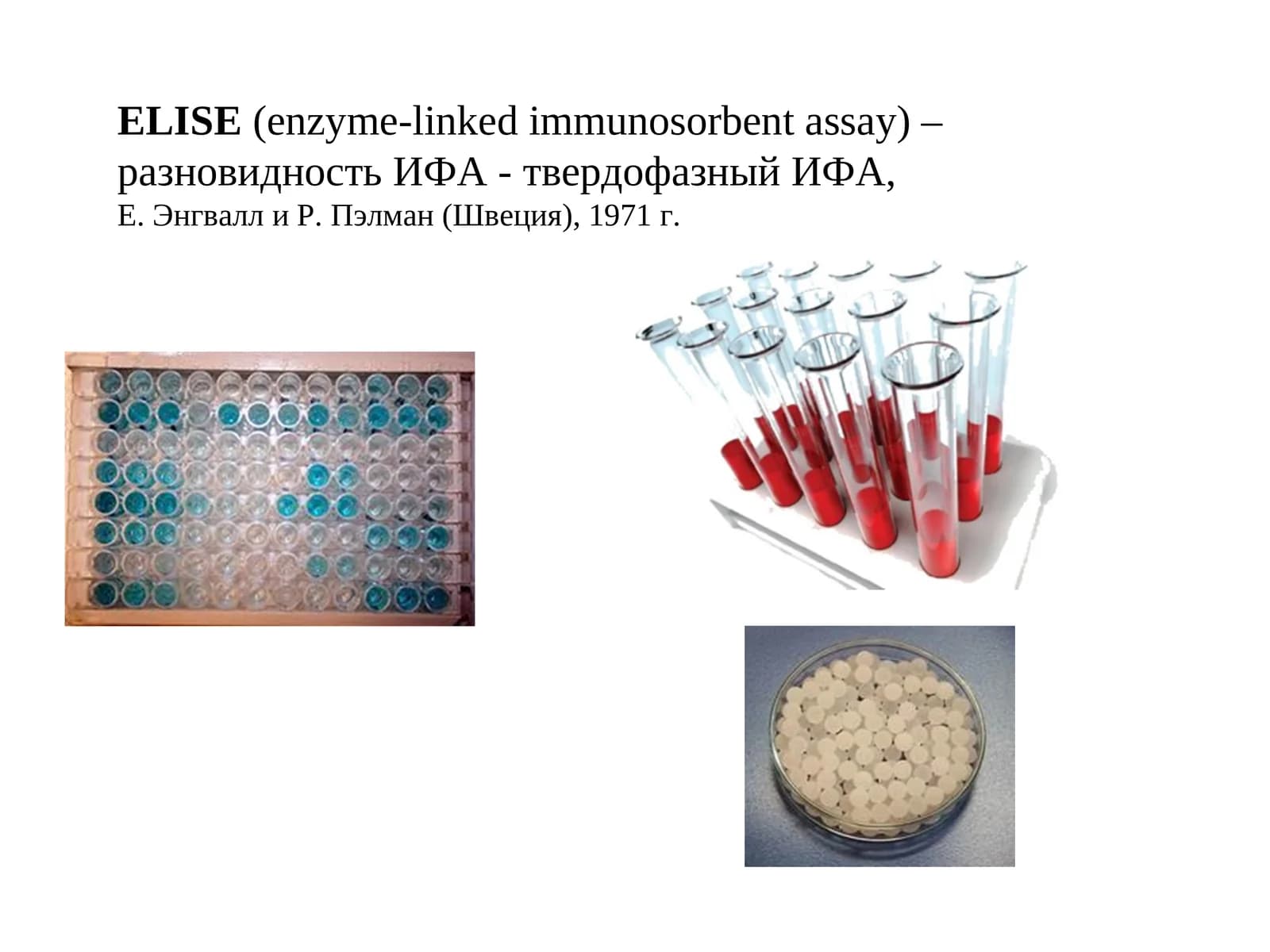ELISE(enzyme-linked immunosorbent assay)