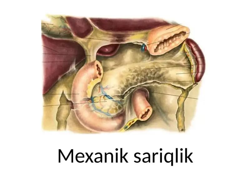 Mexanik  sariqlik