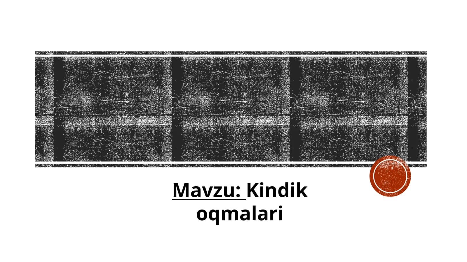 Kindik oqmalari