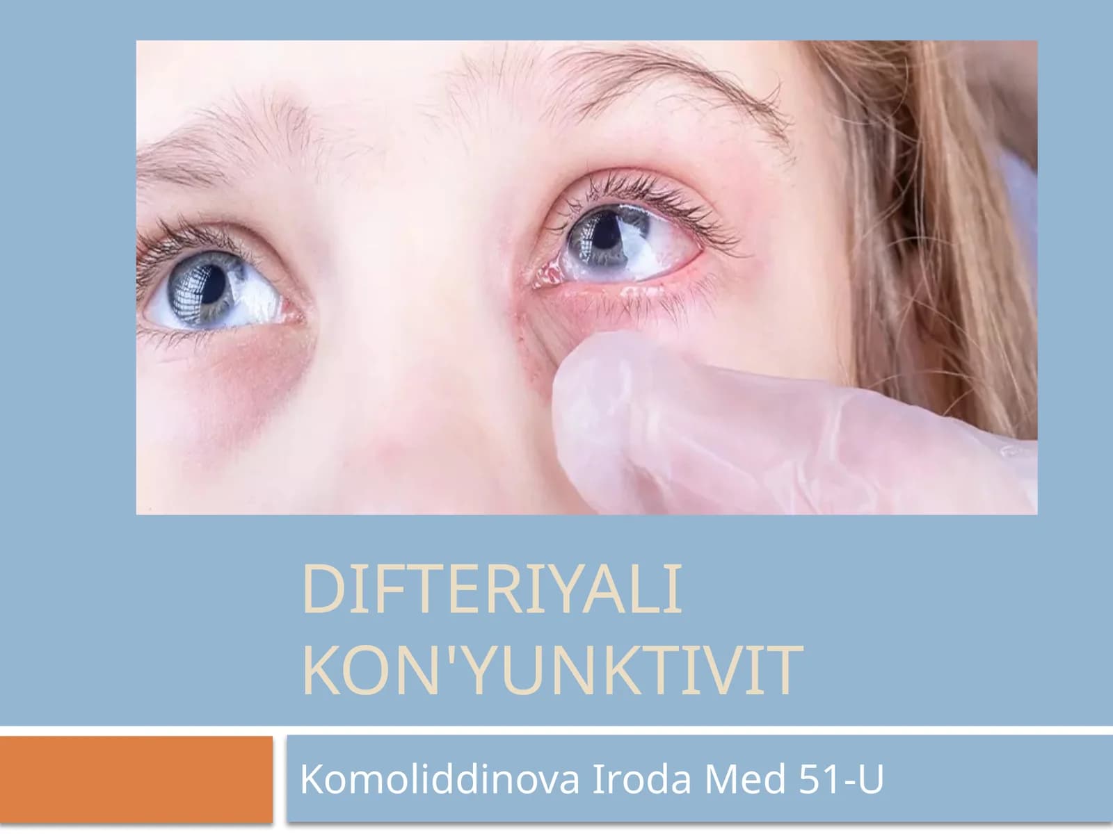 Difteriyali kon'yunktivit