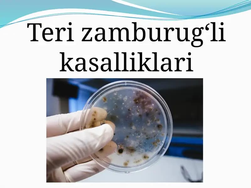 Terining zamburug‘li kasalliklari