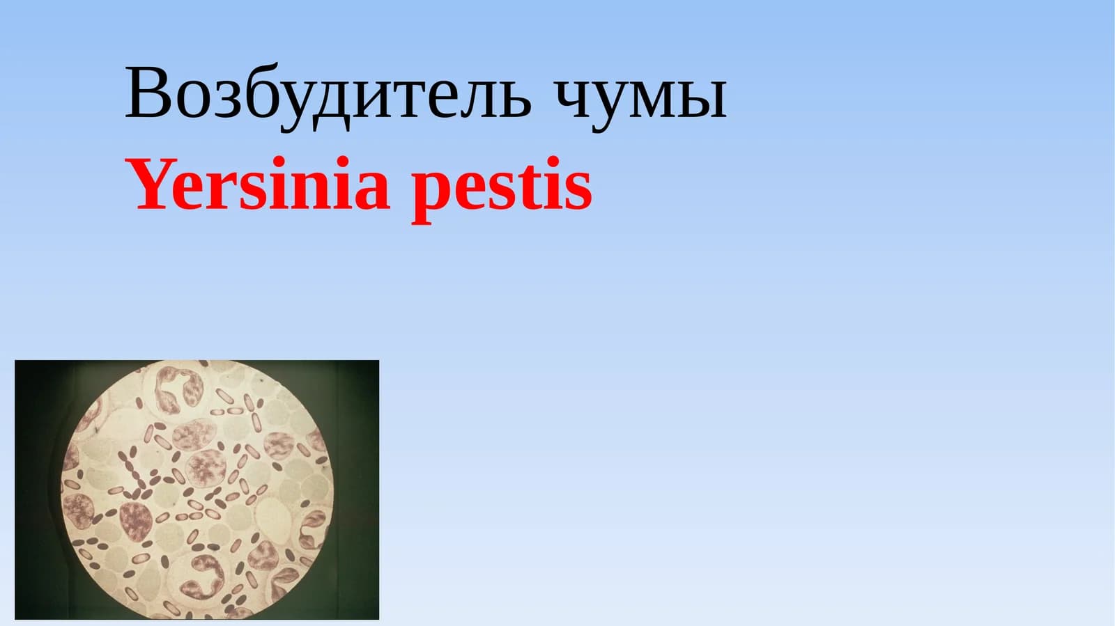 [Возбудитель чумы]