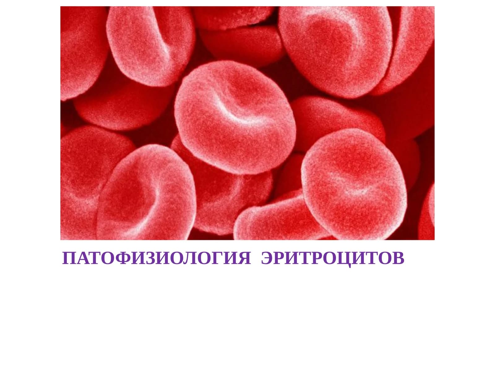ПАТОФИЗИОЛОГИЯ  ЭРИТРОЦИТОВ