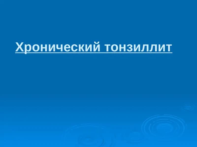 Хронический тонзиллит