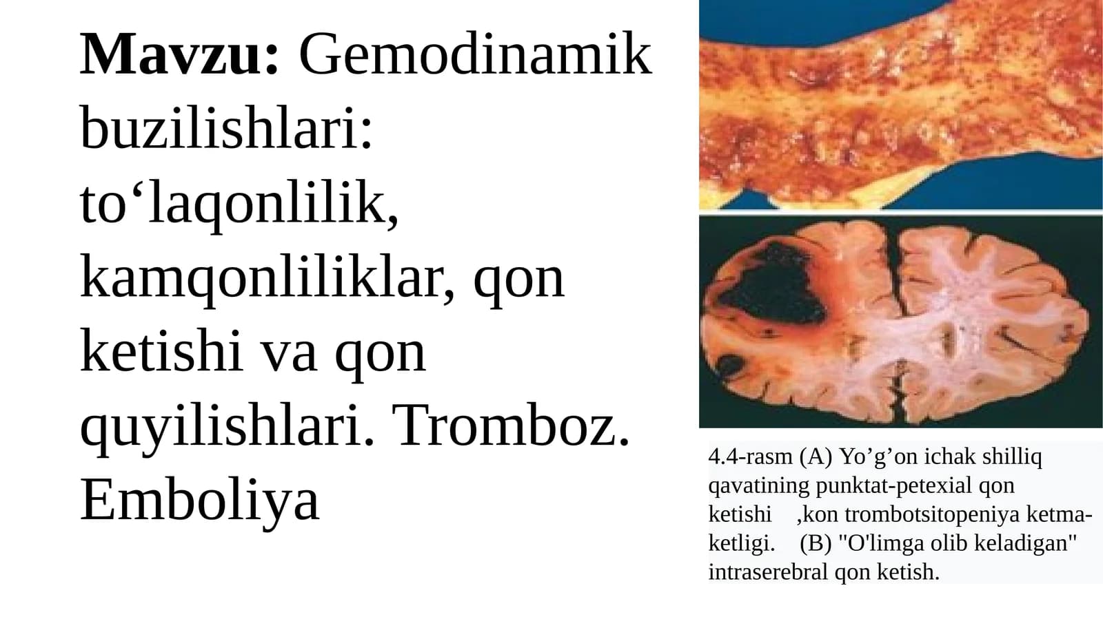 Gemodinamikbuzilishlari
