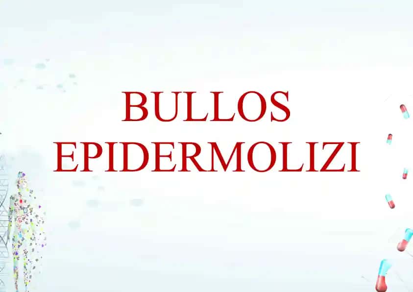 bulloz epidermoliz haqida -Epidermoliz Bullosa