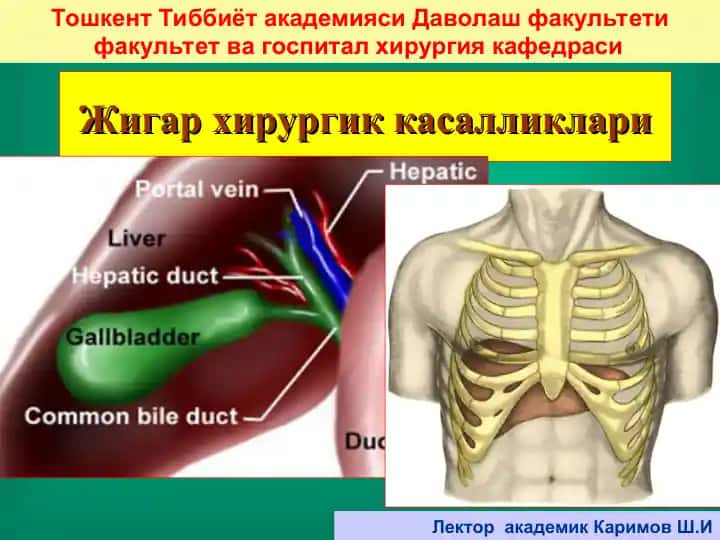 Жигар хирургик касалликлари