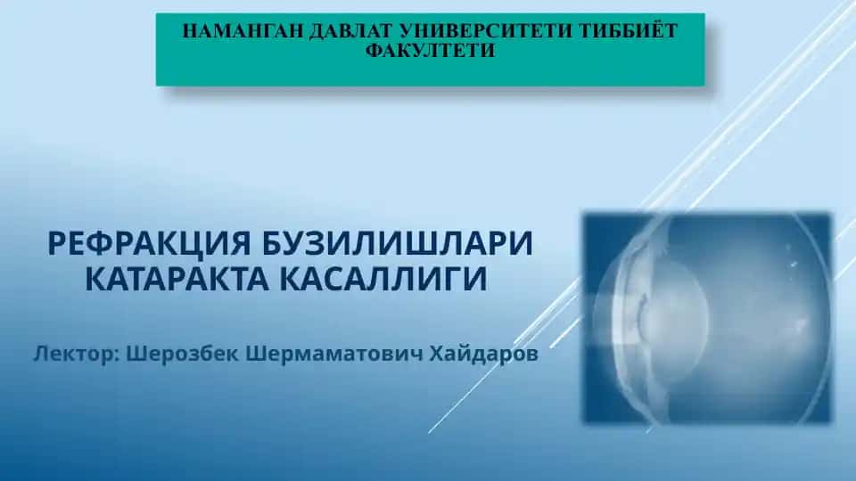 РефракциЯ бузилишлари катаракта касаллиги