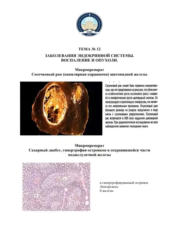 Заболевания эндокринной системы. Воспаление и опухоли.