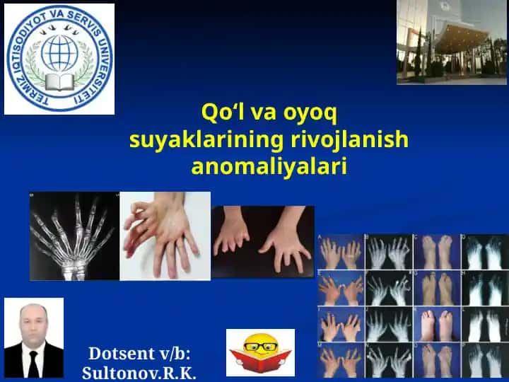 Qo‘lyoqsoyaklarining rivojlanish anomaliyalari