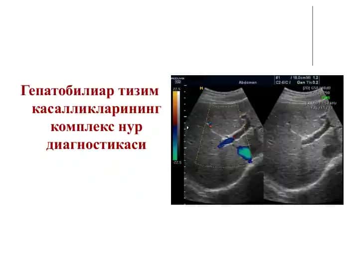 Гепатобилиар тизим касалликларининг комплекс нур диагностикаси