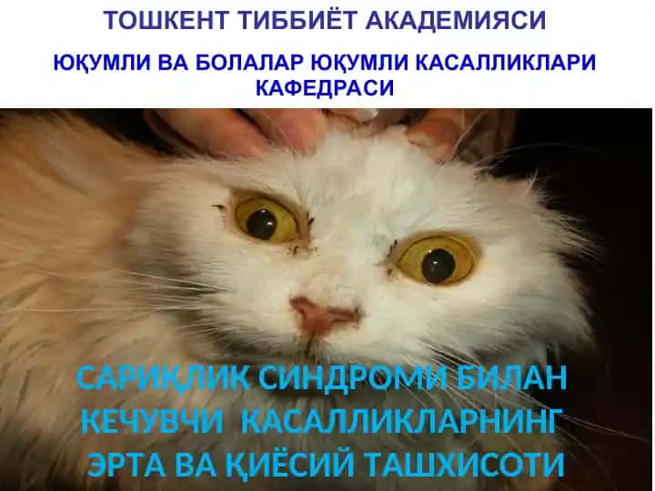 Сариқлик синдроми