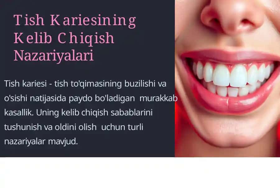 Tish kariesining Kelib Chiqish Nazariyalari