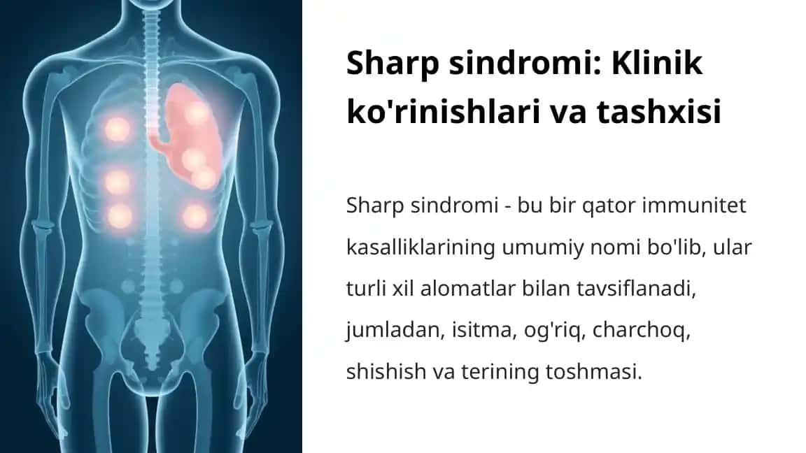 Sharp sindromi: Klinik ko'rinishlari va tashxisi