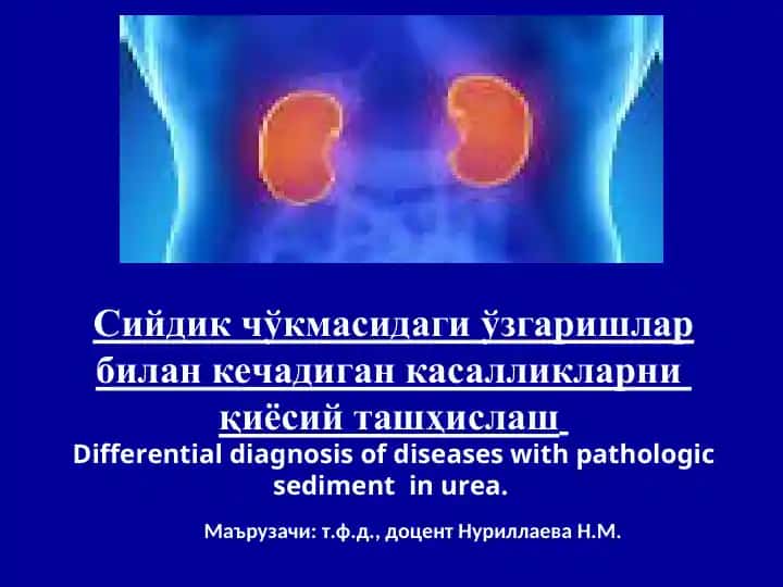 Differential diagnosis of diseases with pathologic sediment in urea