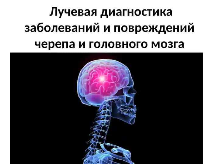 Лучевая диагностика заболеваний и повреждений черепа и головного мозга