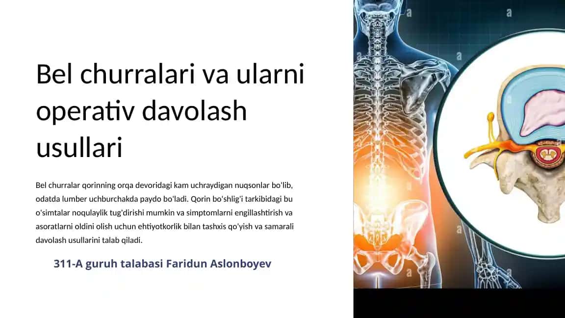 Belchurralar va Uvularni Operativ Davolash Usullari