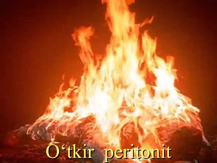 O‘tkir peritonit