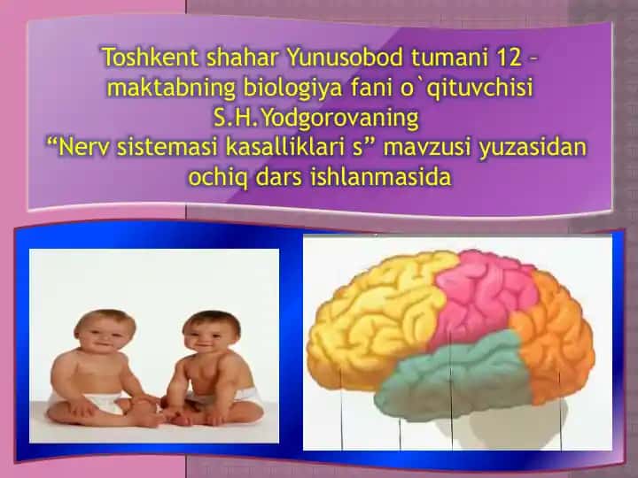 "Nerv sistemasi kasalliklari" ochiq dars ishlanmasi