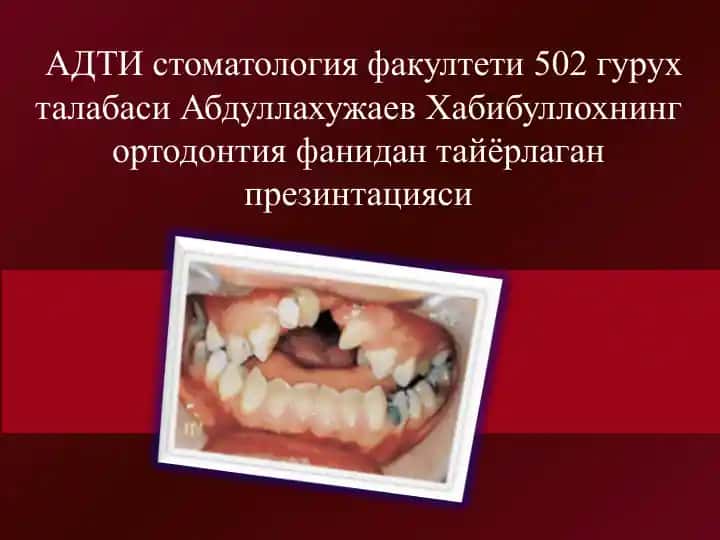 Ортодонтия фанидан тайёрланган презентация