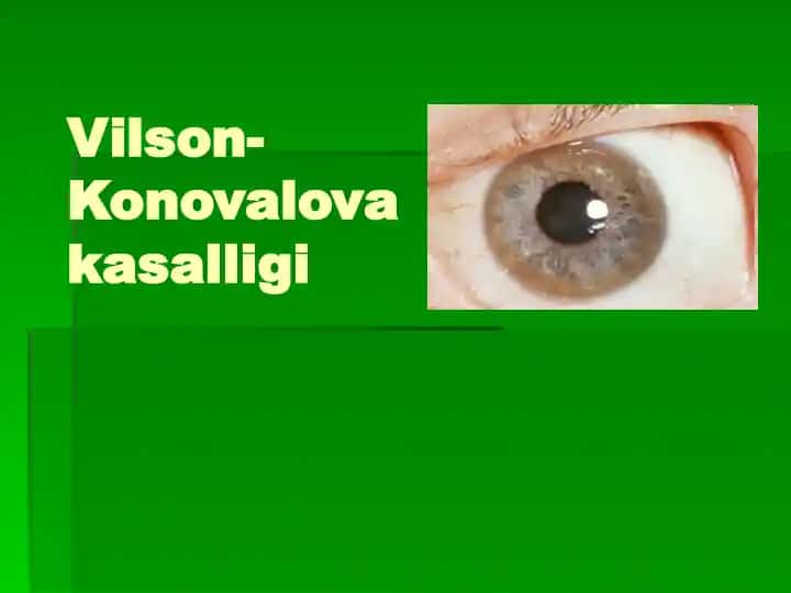 Vilson-Konovalova kasalligi