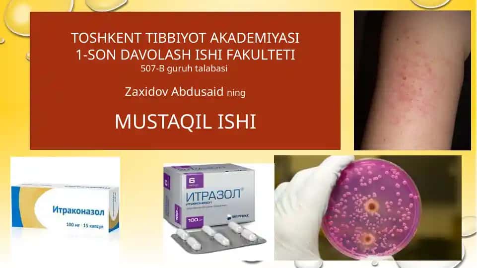 Zamburugʻlarga qarshi dori vositalarining klinik farmokologiyasi